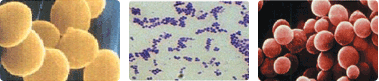 황색포도상구균 미생물 현미경 사진