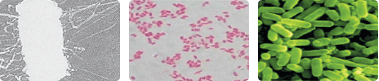 병원성대장균 현미경 사진